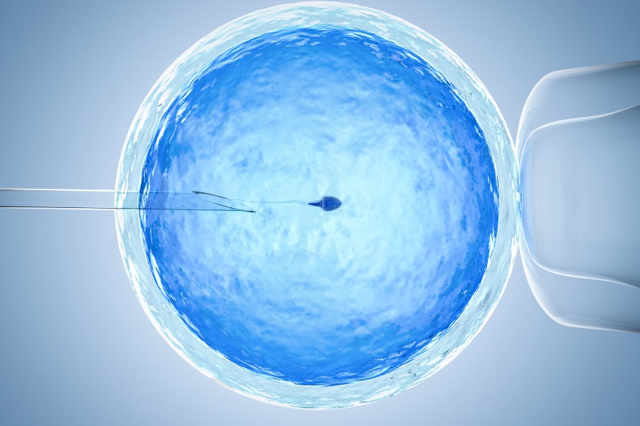 69264500asist.reprodukce